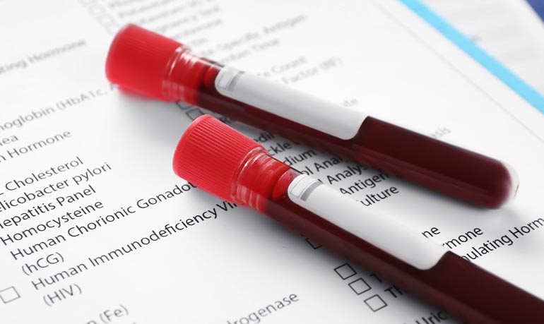 Blood test_biochemical